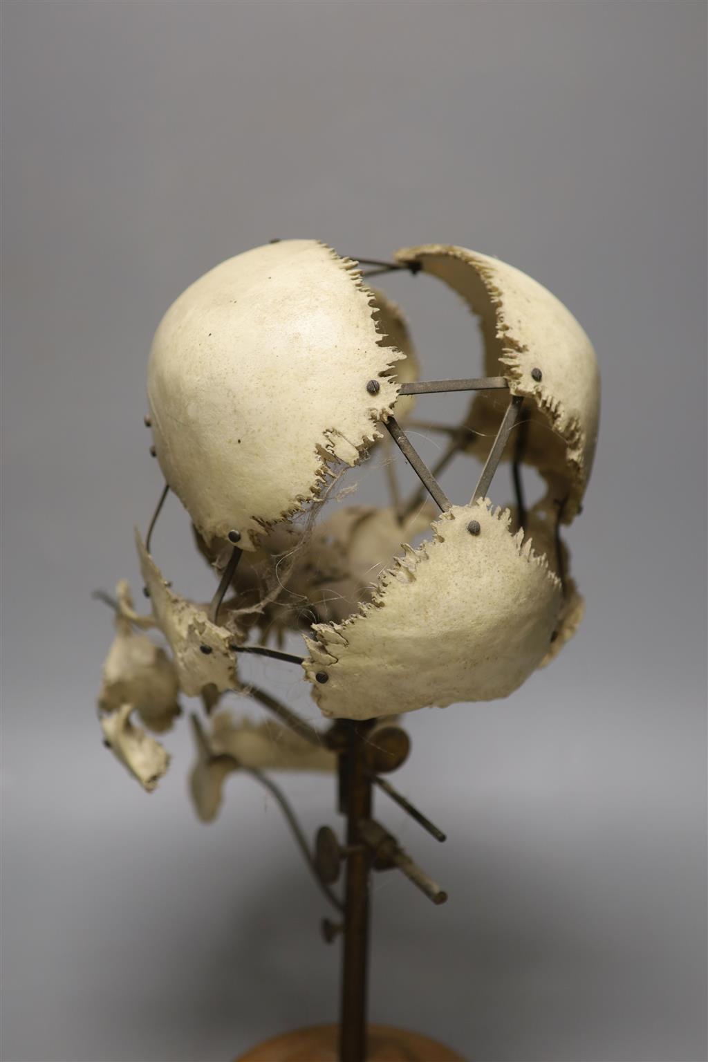 A human skull specimen, 1920s-30s, mounted in exploded form, adjustable brass arms and oak base, 40cm high